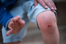 Naše asfaltové hřiště při osobním kontaktu nezná slitování